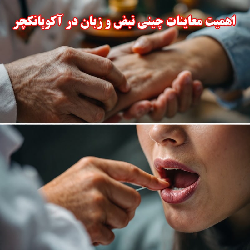 معاینات چینی نبض و زبان در آکوپانکچر