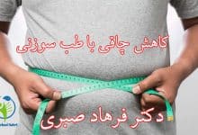 کاهش چاقی با طب سوزنی