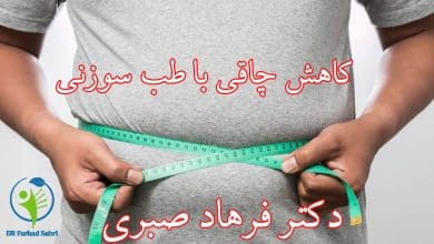 کاهش چاقی با طب سوزنی