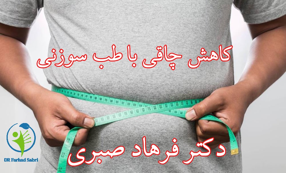 کاهش چاقی با طب سوزنی