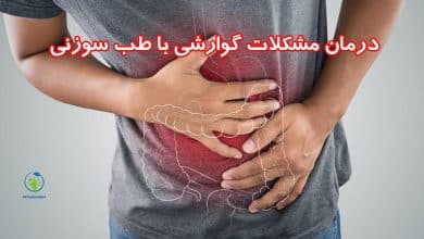 درمان مشکلات گوارشی با طب سوزنی