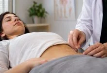 طب سوزنی برای ناباروری زنان