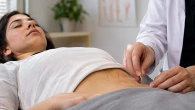 طب سوزنی برای ناباروری زنان