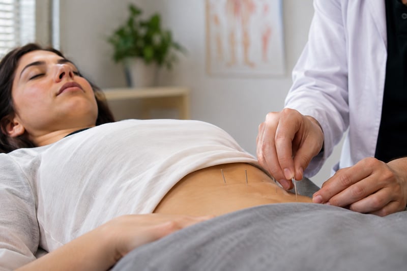 طب سوزنی برای ناباروری زنان