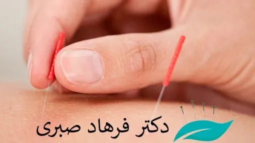 کمک به درمان سرطان با طب سوزنی