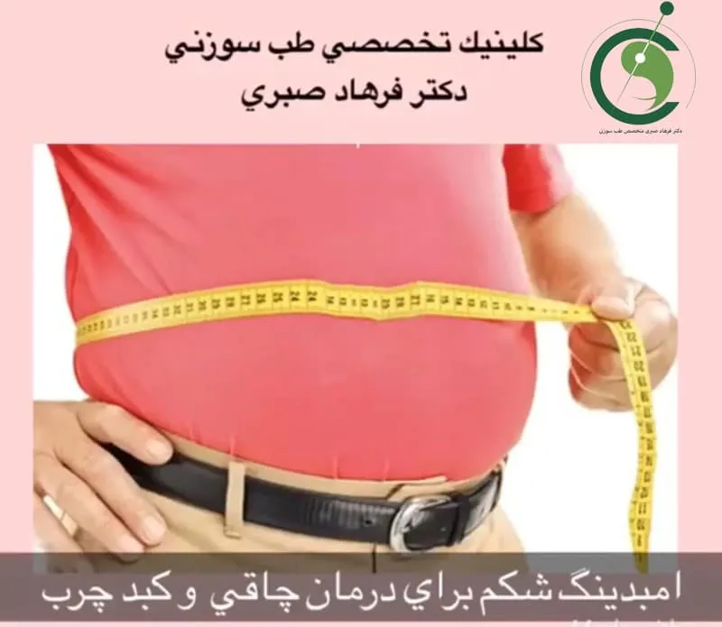 چاقی و طب سوزنی