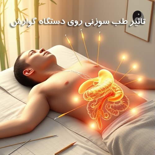 تاثیر طب سوزنی بر دستگاه گوارش